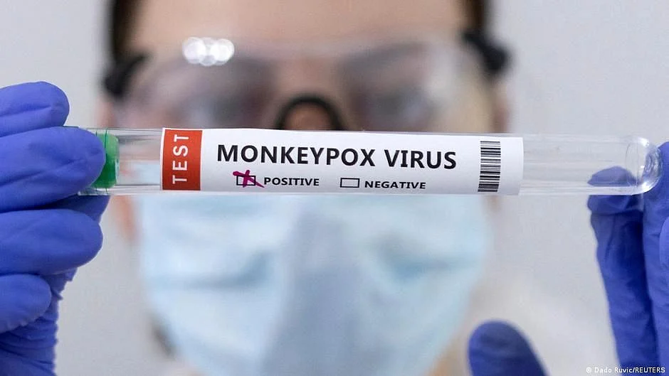 Nigerian woman tests positive for monkeypox in Delhi, India's tally rises to 13