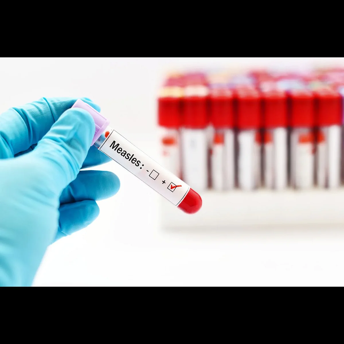 Administer one additional dose of measles, rubella vaccines to children in vulnerable areas: Centre to states