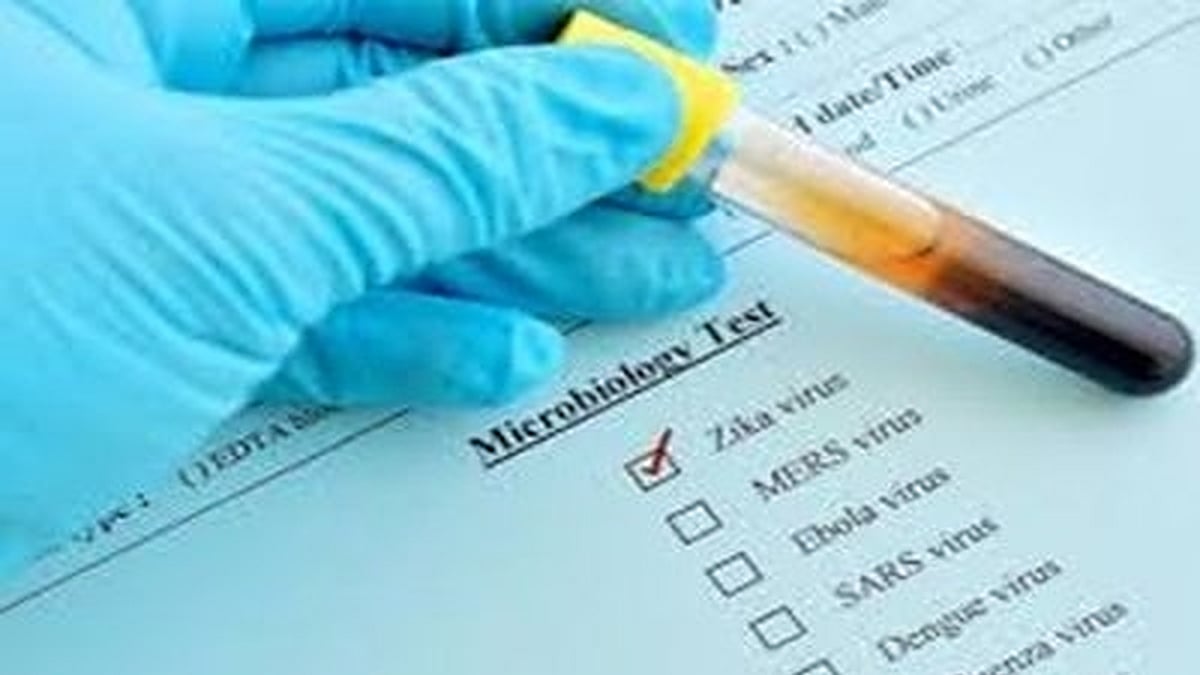 K'taka on alert as first case of Zika virus surfaces