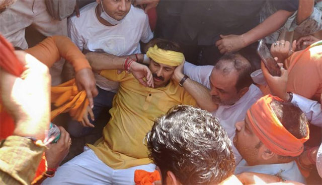 दिल्ली में प्रदर्शन के दौरान घायल हुए बीजेपी सांसद मनोज तिवारी, अस्पताल में कराना पड़ा भर्ती
