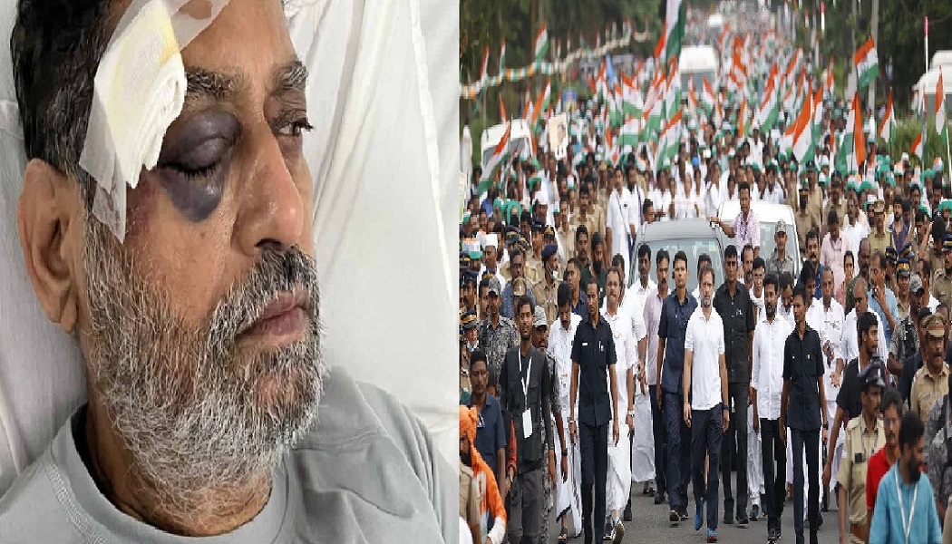 'भारत जोड़ो यात्रा' के दौरान कांग्रेस नेता और महाराष्ट्र के पूर्व ऊर्जा मंत्री नितिन राउत हुए घायल, पुलिस ने दिया था धक्का