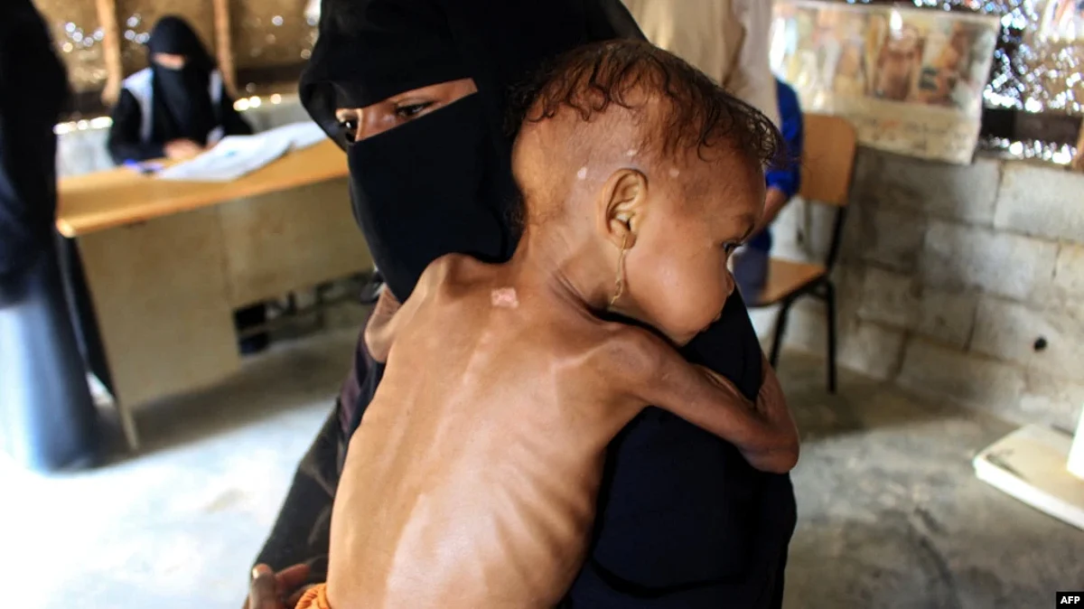 193 million people globally experienced extreme hunger last year