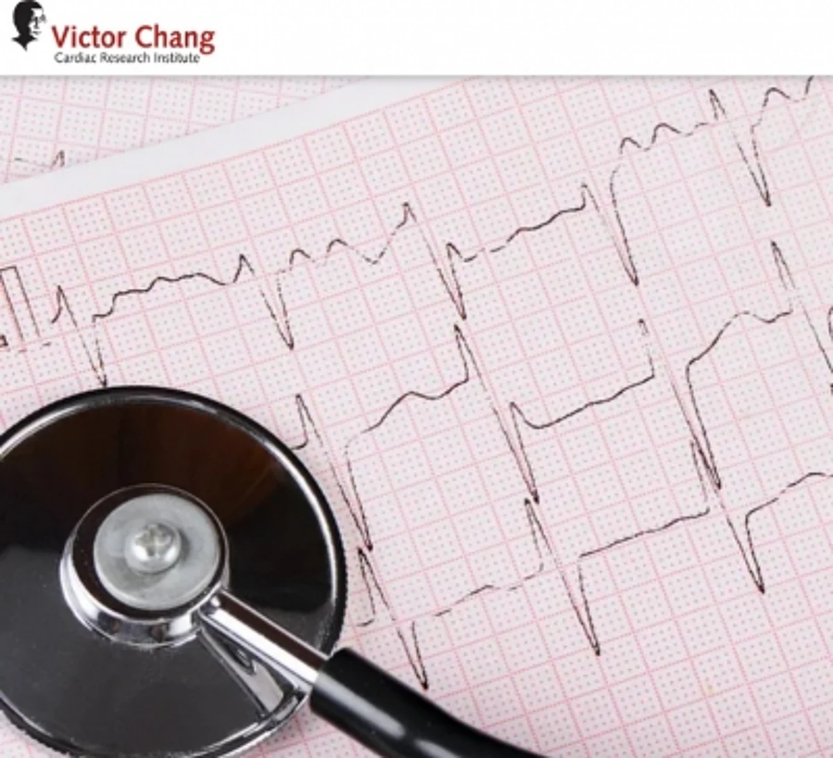 New MRI technique set to transform heart transplant care