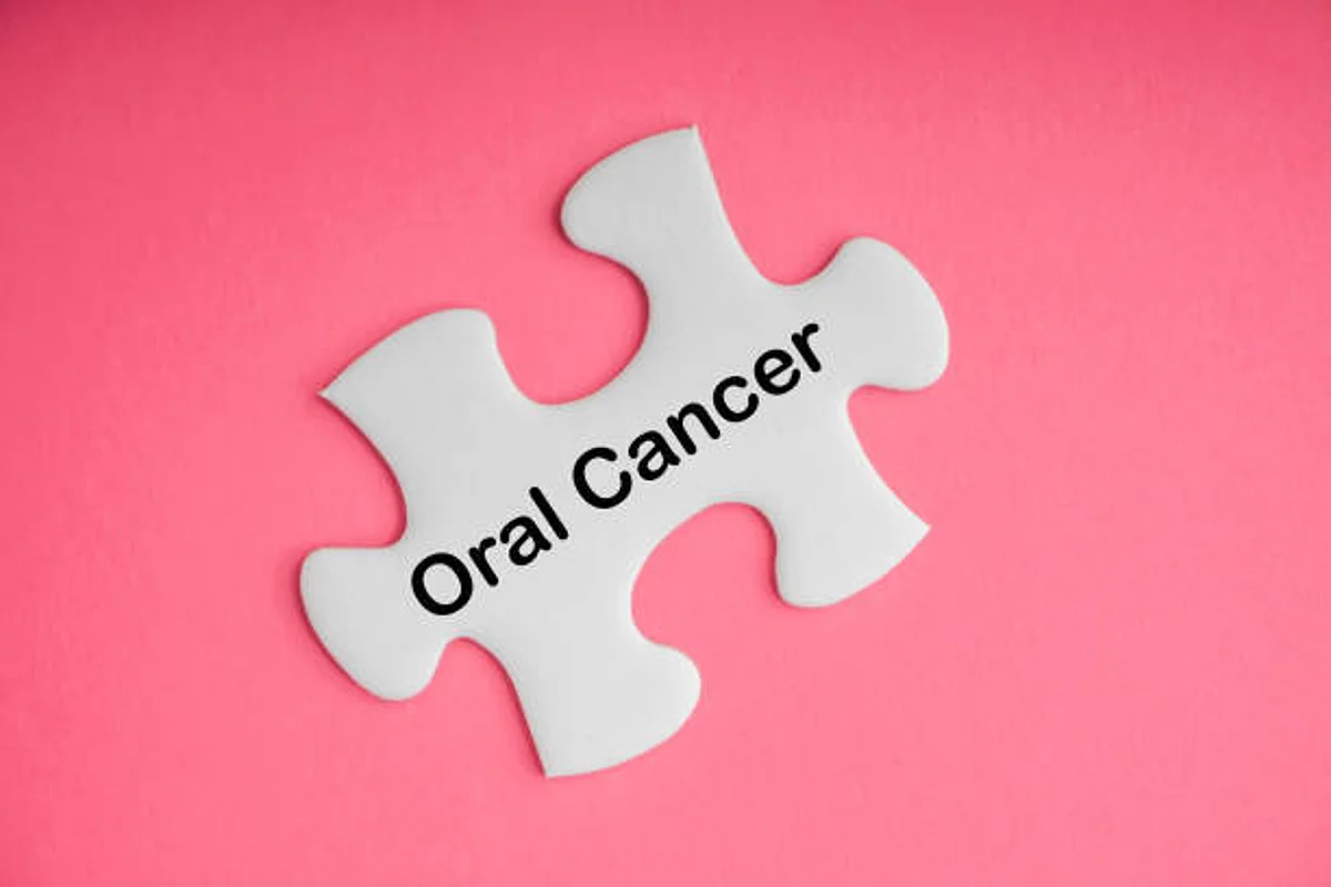 Researchers may soon diagnose Oral Cancer without a biopsy
