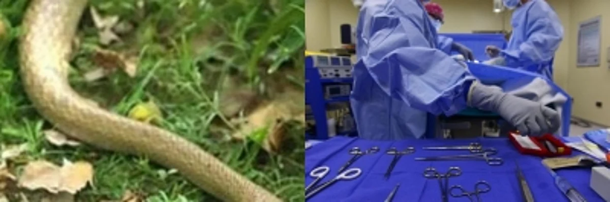 Treated a woman from Bihar who was bitten by a cobra. (IANS)