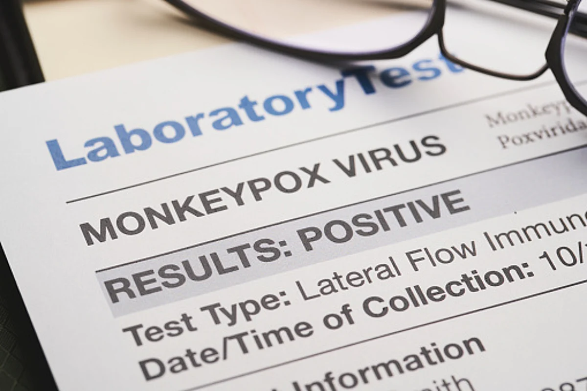 According to the World Health Organization, the disease has a fatality rate of around 3 to 6 per cent.
