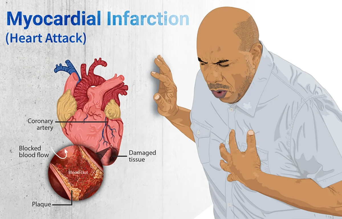 People are unable to identify a number of external or internal conditions affecting their hearts. (Representative Image)