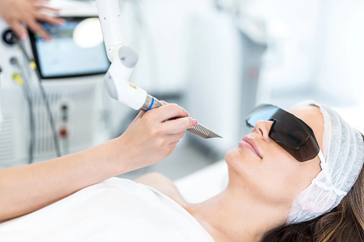 A women getting laser skin treatment.