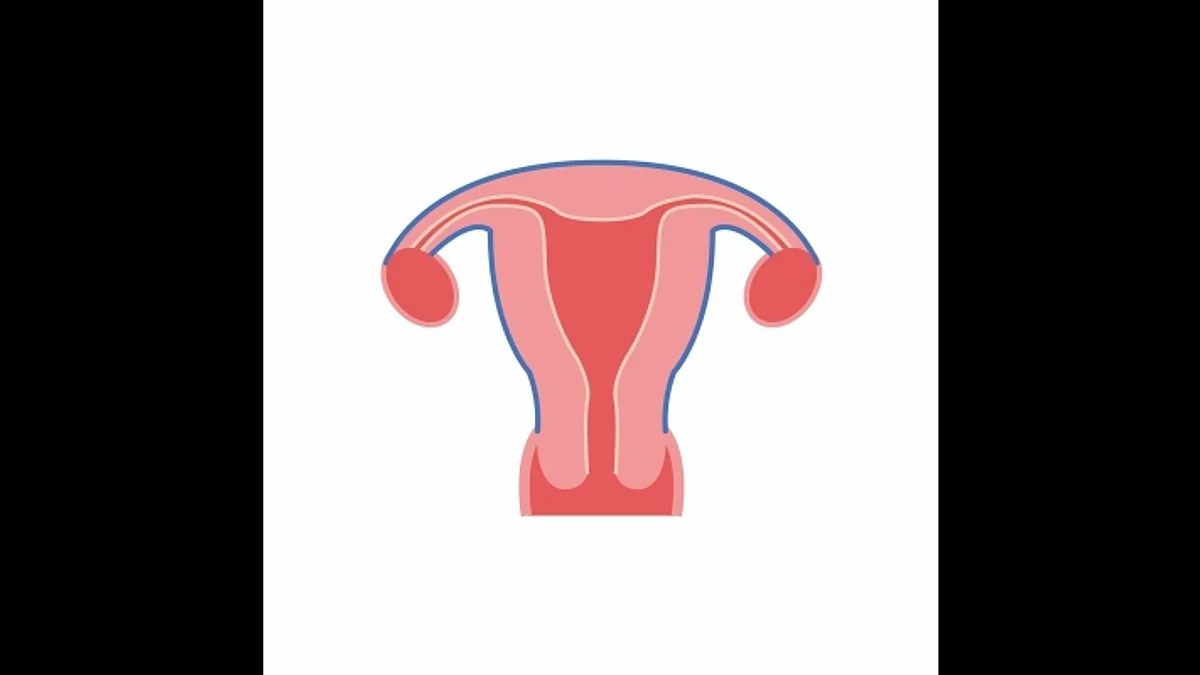 India sees a high number of uterus removal cases, even among much younger women, which may inflict a physical, social, and mental health burden on them, experts said. (Representative Image)