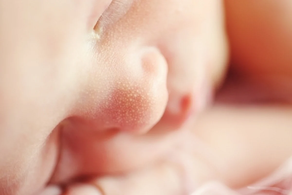 Horrific Report on Children's Day-Eve, 78K Infants Die Annually in India Due to Heart Disease.