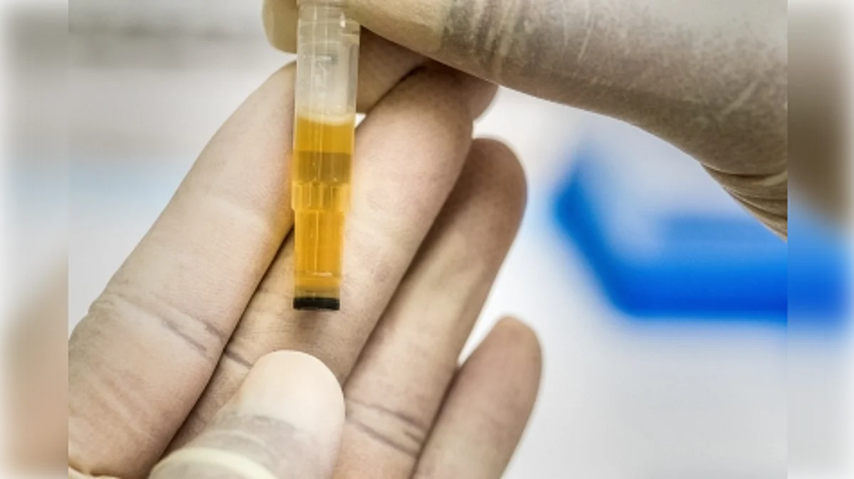 Researchers at the Beatson Institute for Cancer Research in Scotland now have discovered a metabolite in mice that could lead to the development of a new urine test to detect the beta-catenin mutated form of liver cancer, reports BBC. (Representative Image- IANS)