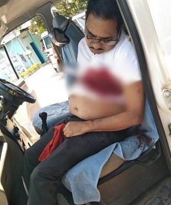 Sharad Babu was a resident of Hyderabad. His family members have been informed about the tragic incident. [IANS]&nbsp;