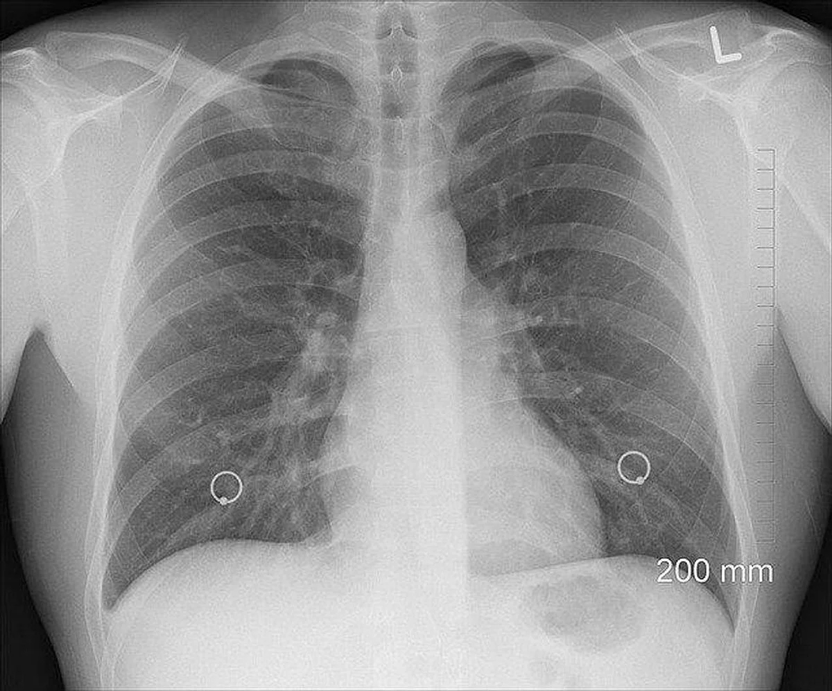Research Suggests That Your Lungs Can Smell