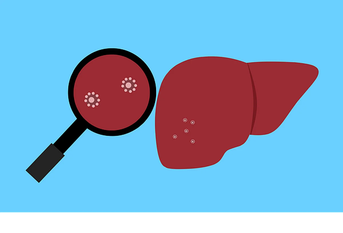 Liver Disease May Raise Risk of Heart Problems: Study