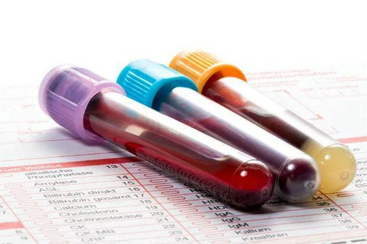 Rapid Blood Test Can Predict Severe Disease Risks in COVID Patients