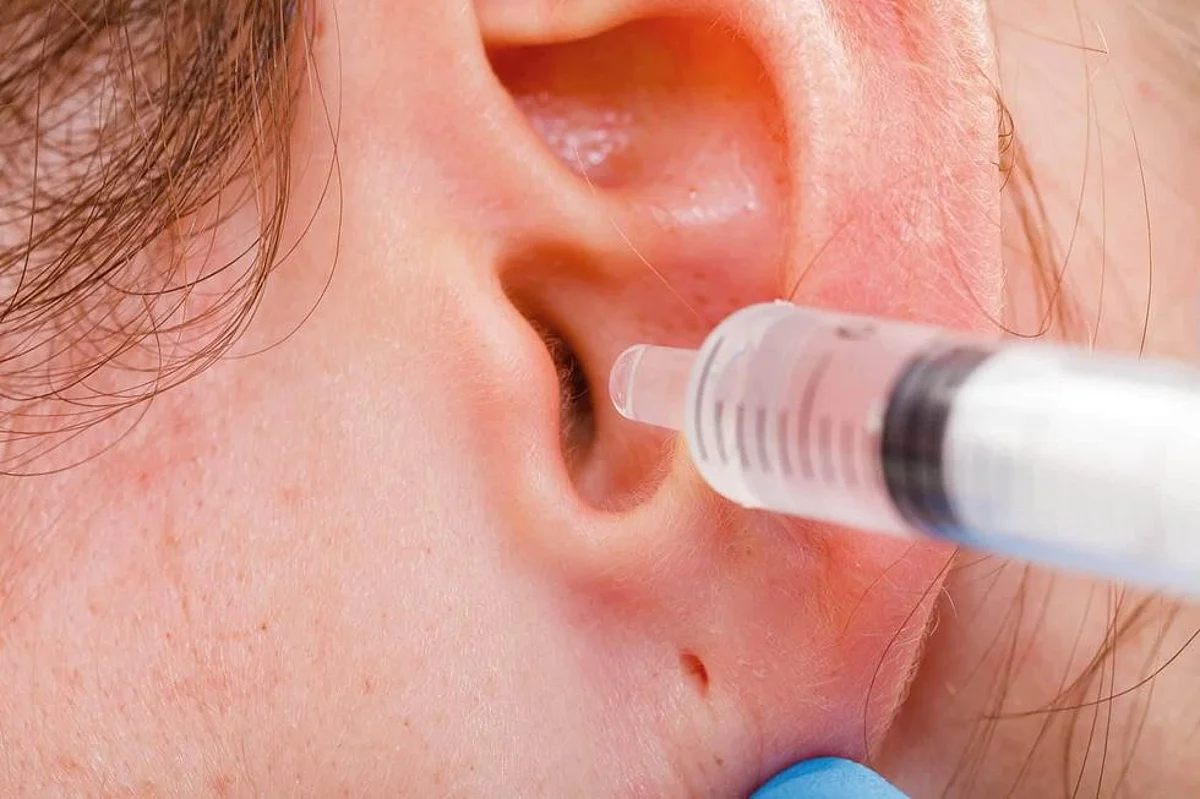 New Device to Sample Earwax Measures Stress Level