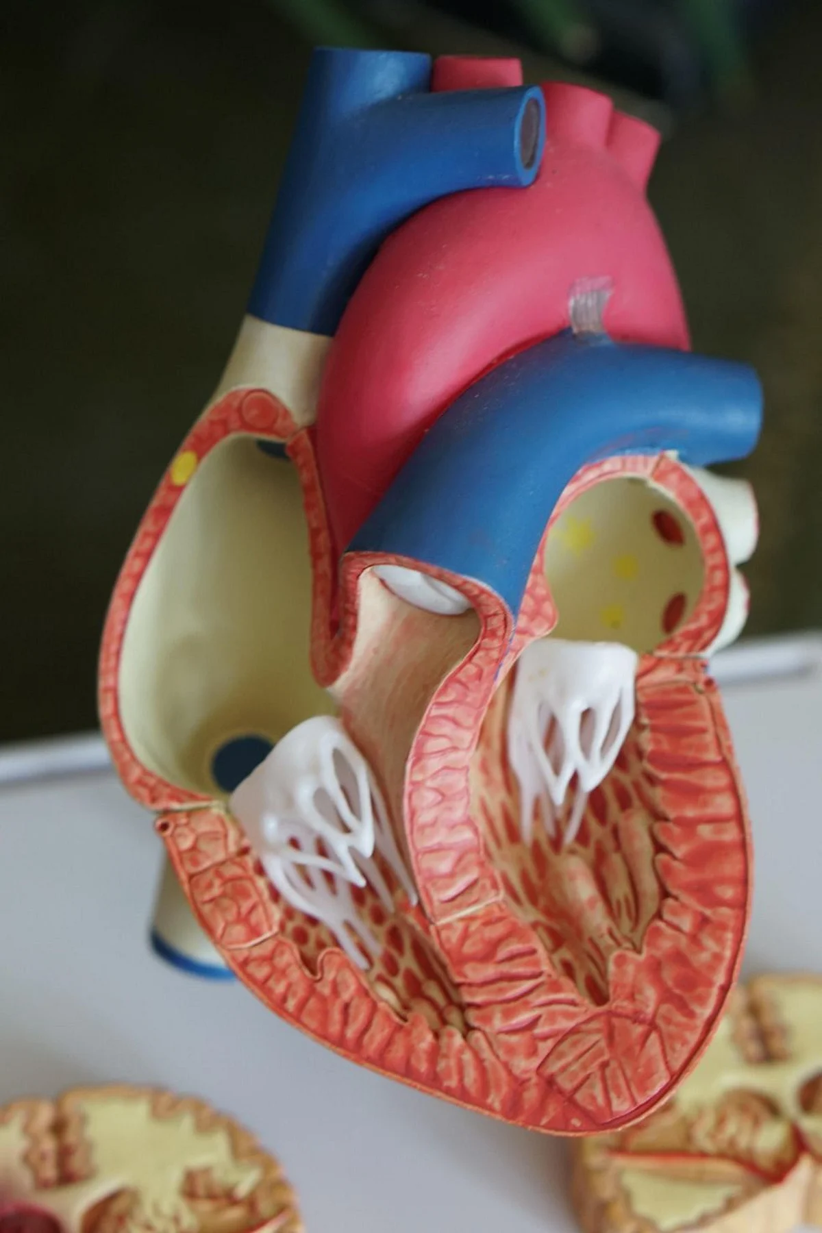 Return to Usual Sexual Activity After Heart Attack for Long-Term Survival