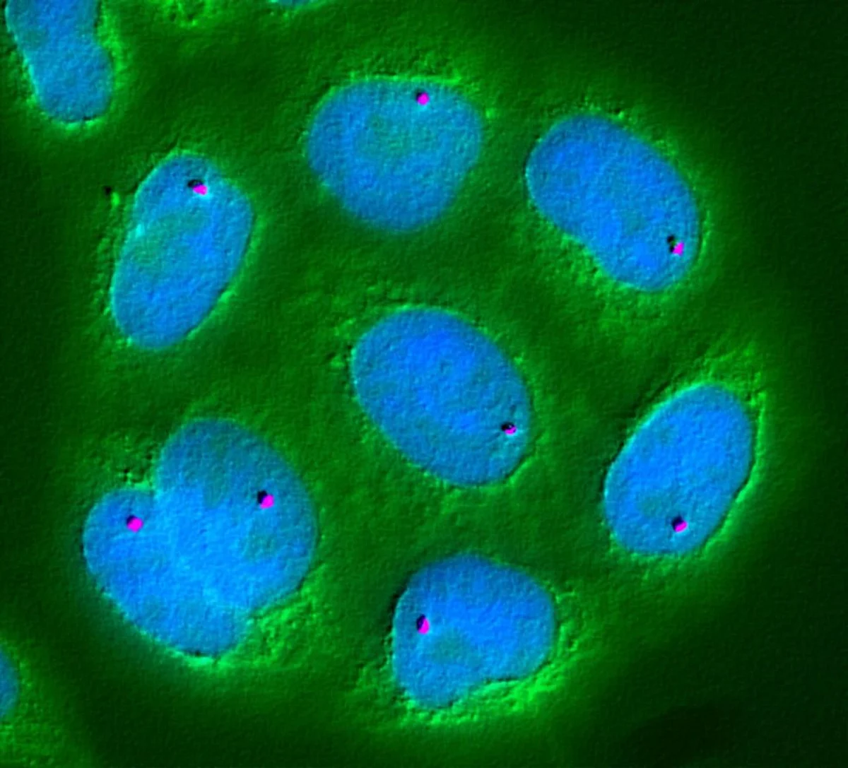 Indians Should be Thankful to Their Genes for Low Mortality Rate: Scientists