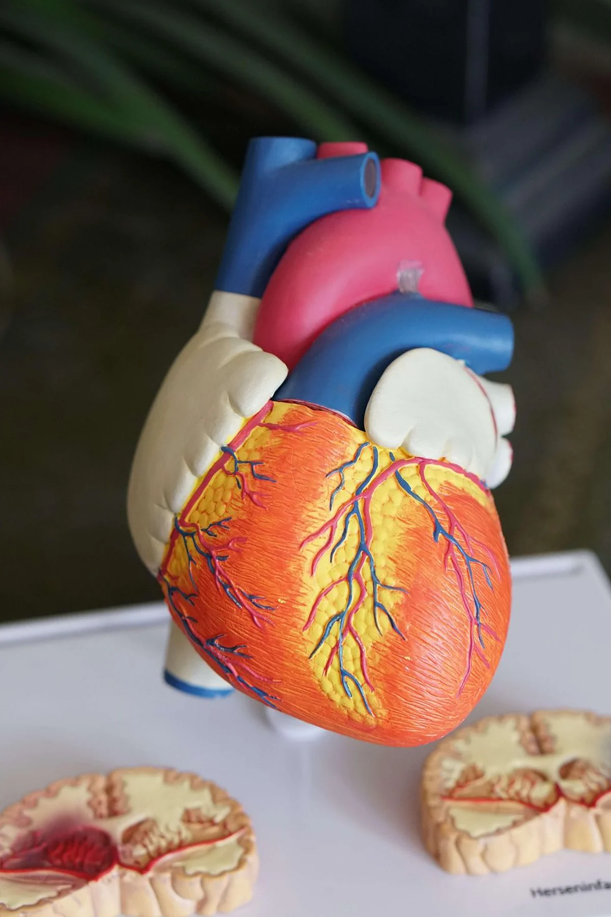 20% Cardiac Patients Not Visiting Hospitals Due To Fear Of Covid-19: Report