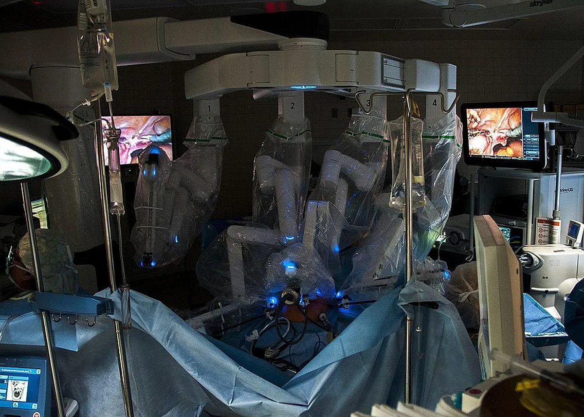 Robot Assisted Surgery is Linked to The Cost of The Equipment