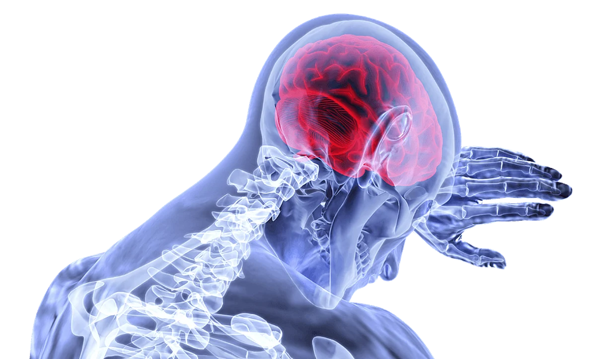 Novel Stroke Treatment Repairs Damaged Brain Tissue