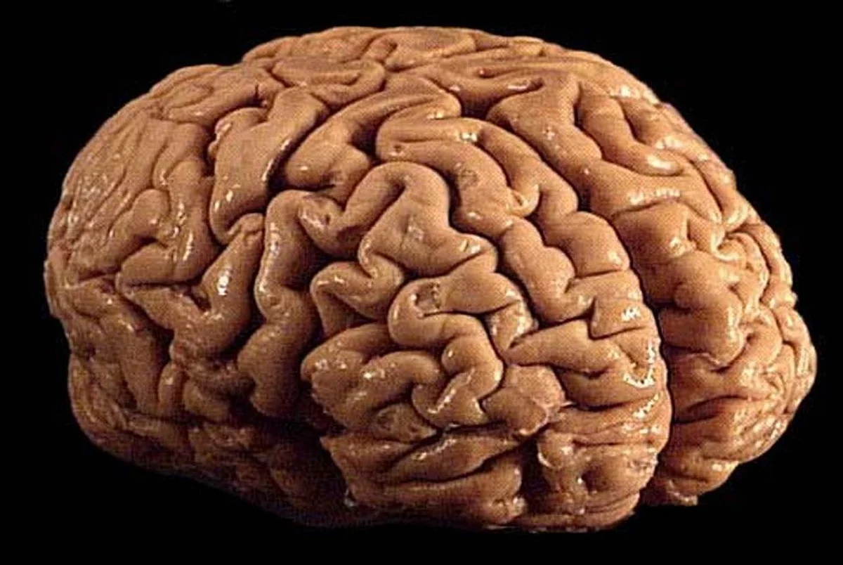 Novel stroke treatment repairs damaged brain tissue