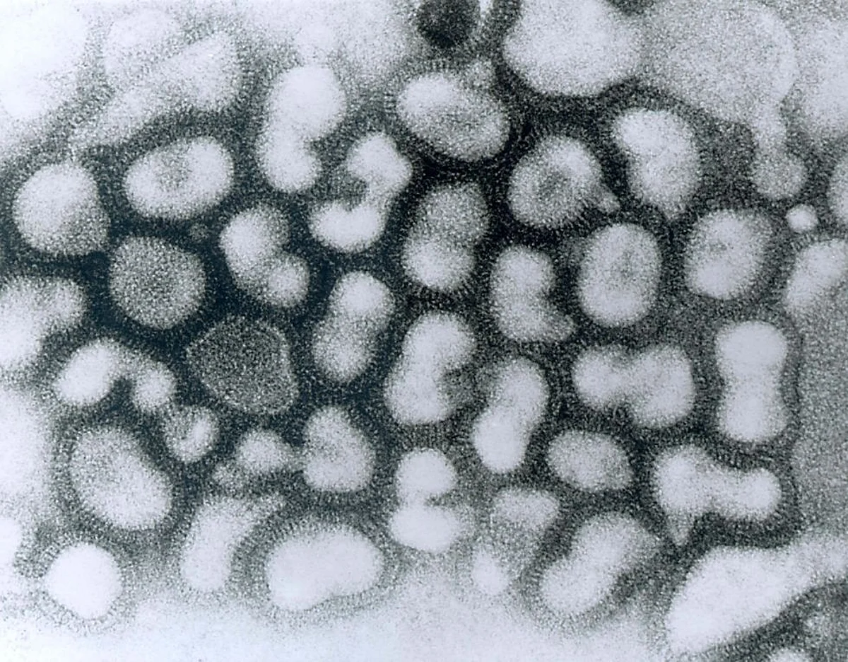 Scientists discover UV light to kill flu virus