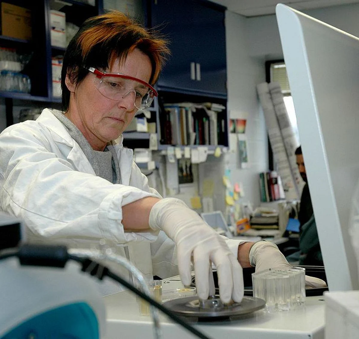 Harnessing sperm may help fight cervical cancer