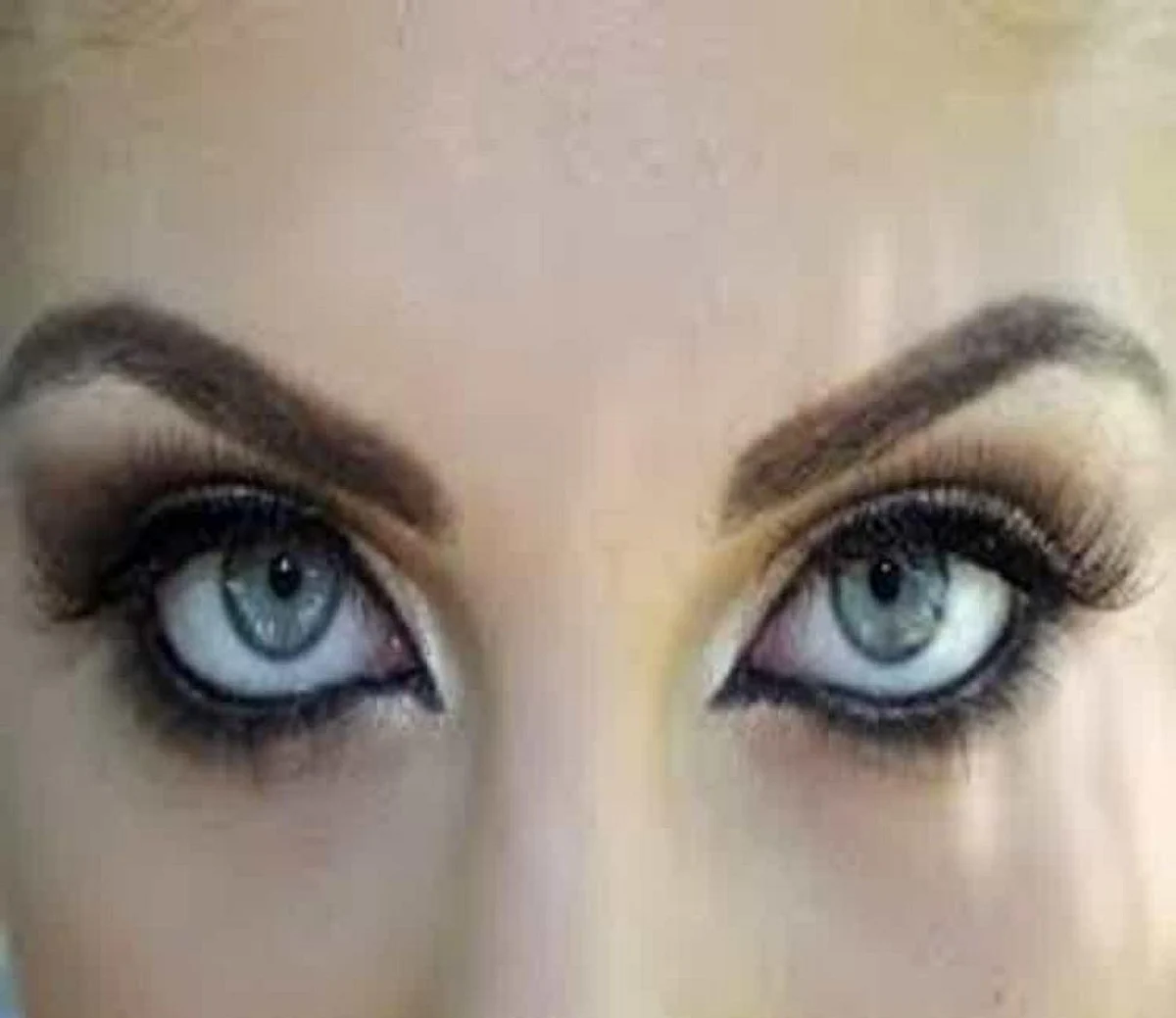 7 Easy Homemade Tips to remove Dark Circles Naturally