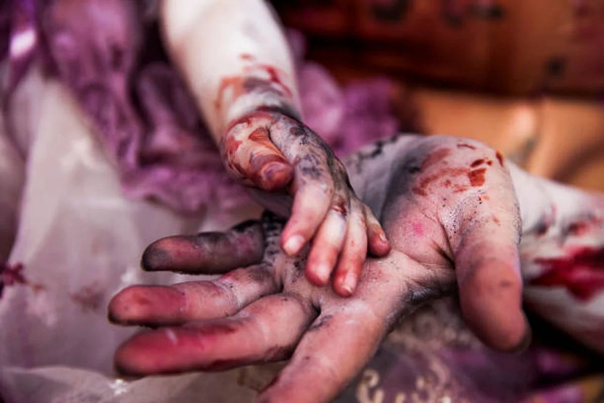 At least 191 children have been killed and over 350 have been injured so far in the war-torn Ukraine due to Russian invasion. (Unsplash)