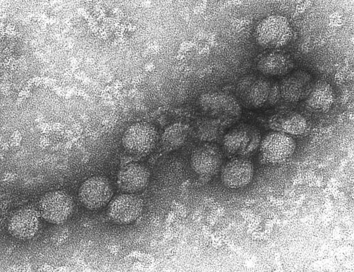 केरल में Tomato Flu के बाद अब West Nile Virus का आतंक