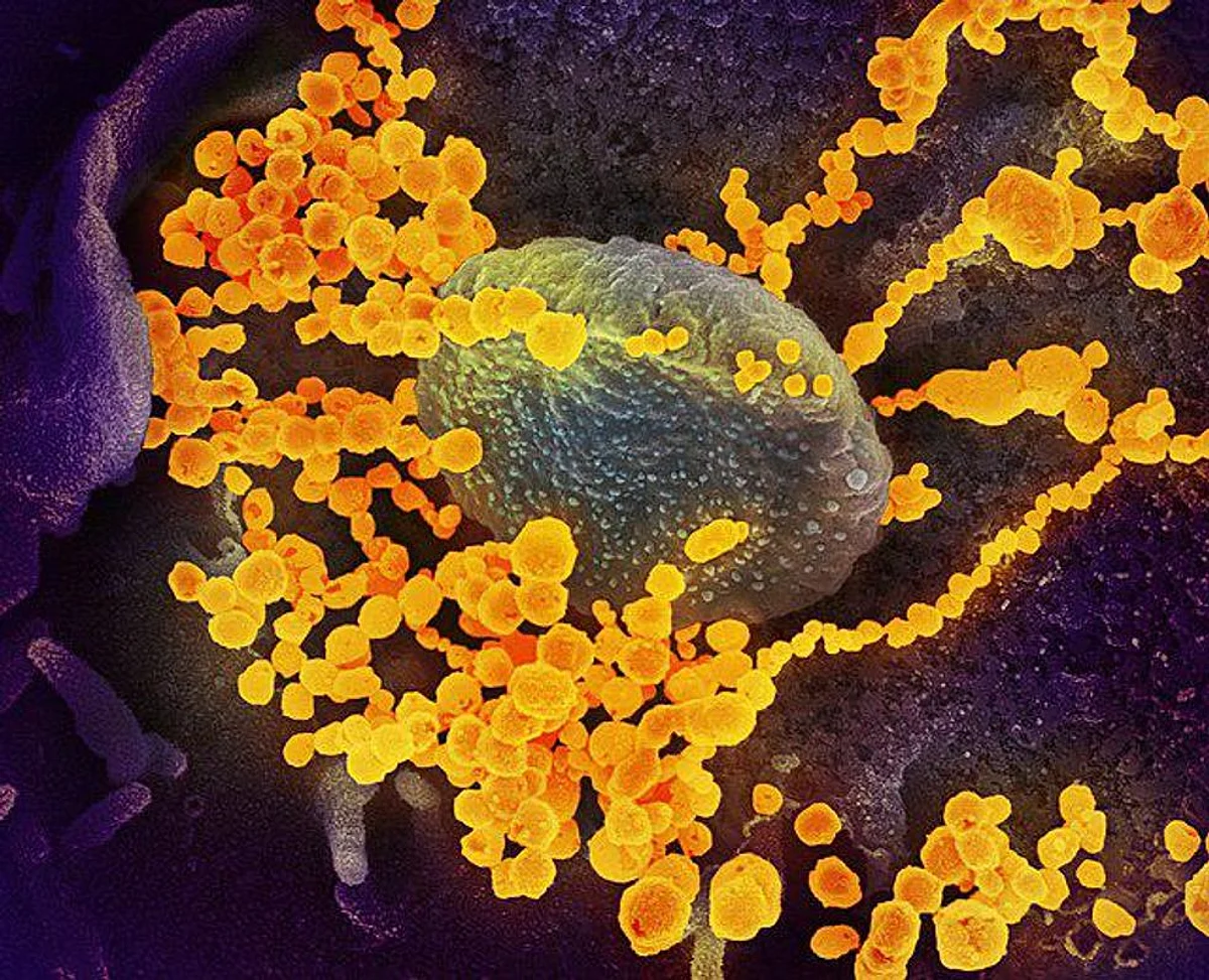 SARS-CoV-2 Virus