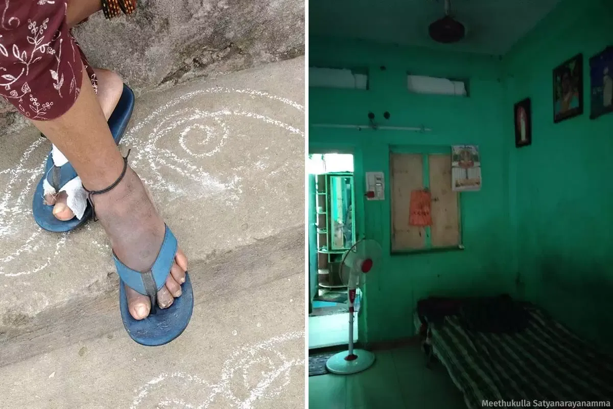 Vidya’s leg which has become gangrenous (L). Her small, poorly ventilated house which has barely any light during the day time.