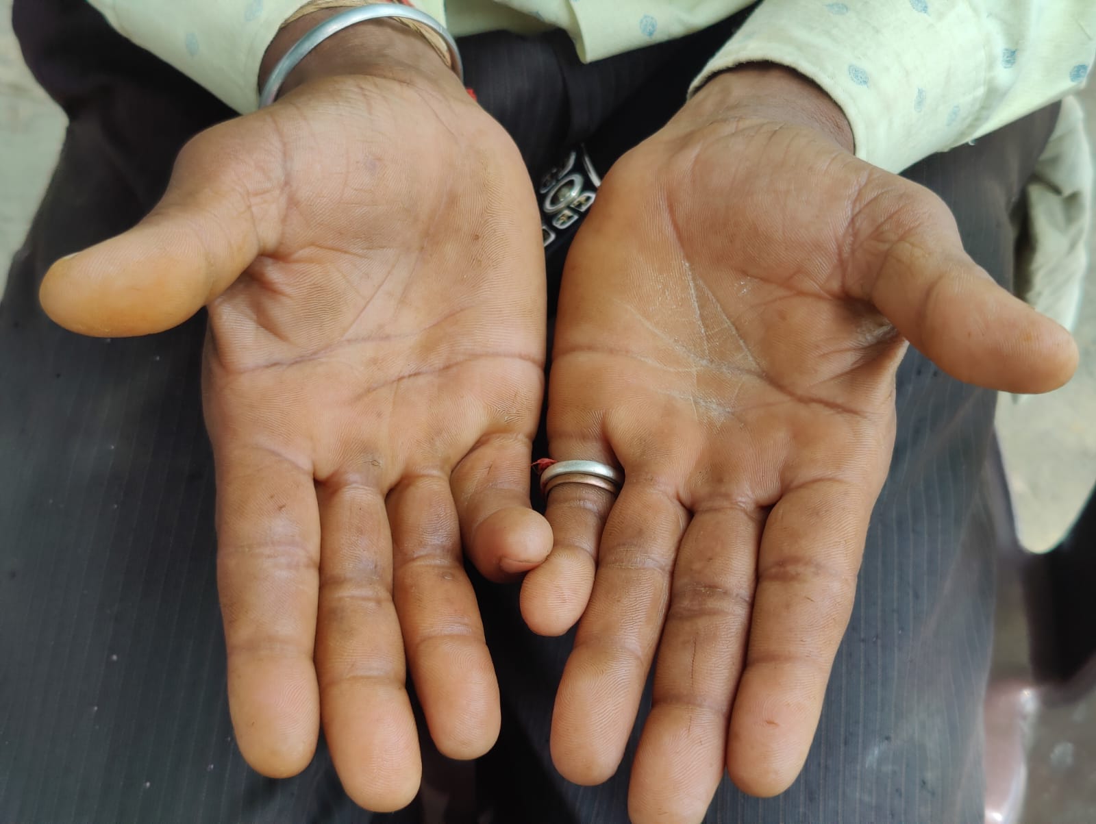 Shravan Singh's hands