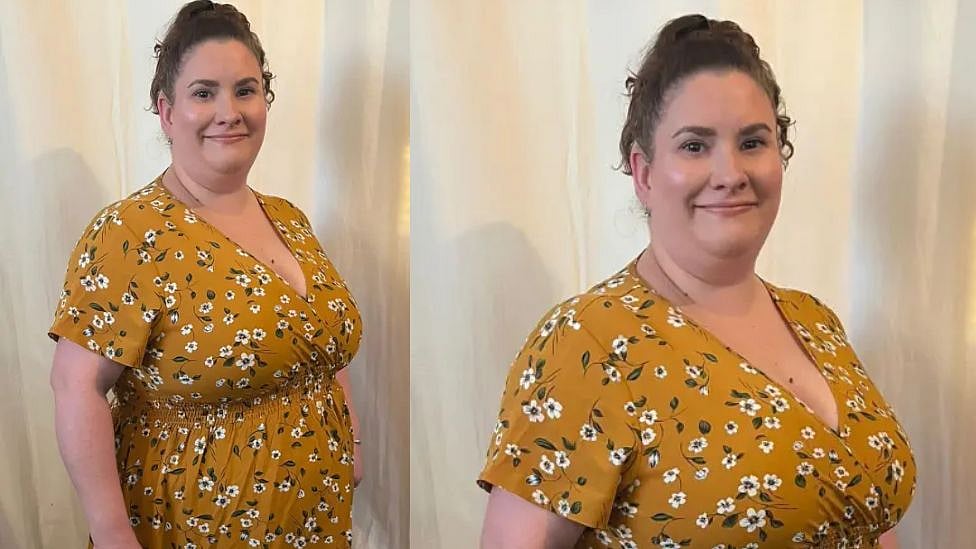 ”மன உளைச்சலாக இருக்கிறது” - மார்பகத்தின் அளவை குறைக்க நிதி திரட்டி வரும் பெண்