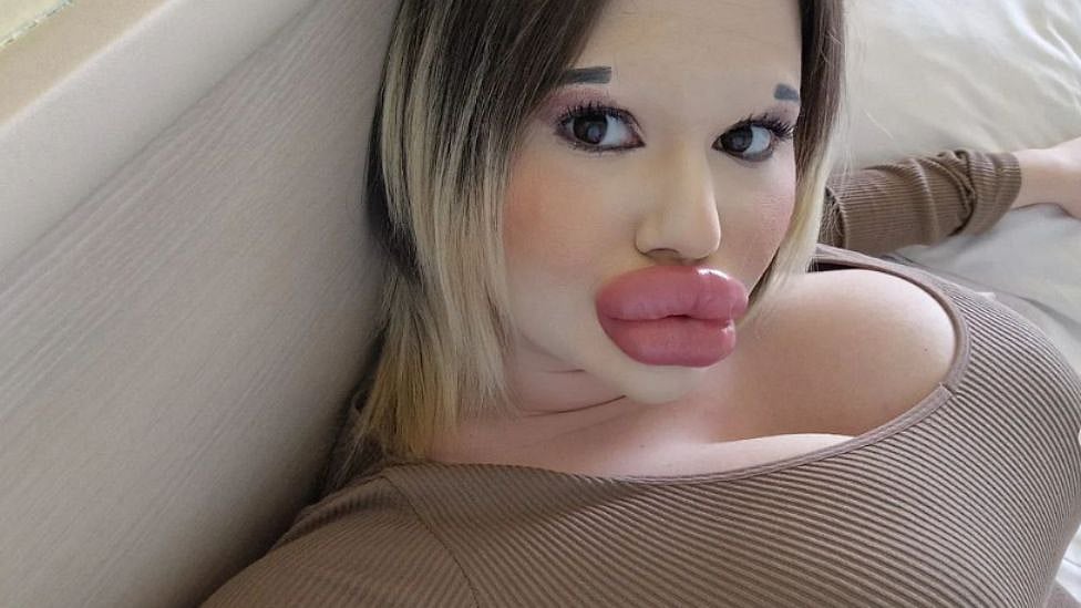 உலகின் மிகப்பெரிய உதடுகளைக் கொண்ட பெண் - ரூ.7 லட்சம் செலவு செய்து மாற்றியது ஏன்?