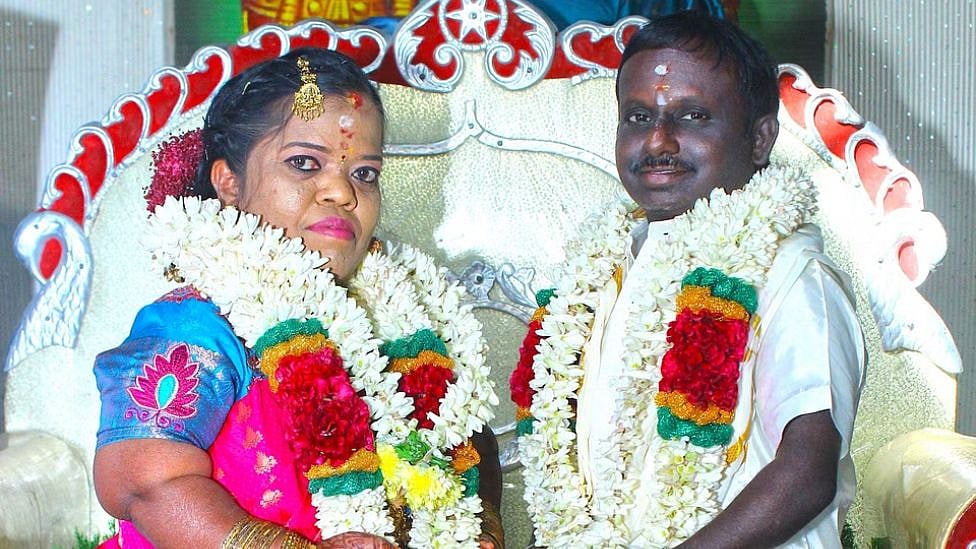 கரூர் : திருமணம் செய்து கொண்ட உயரம் குறைவான மாற்றுத்திறன் ஜோடி - மணமகன் நெகிழ்ச்சி!