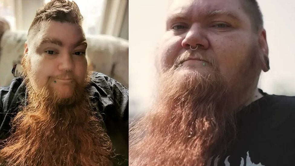 Erin Honeycutt: உலகின் மிக நீண்ட தாடி கொண்ட பெண்- சந்தித்த  இன்னல்கள் என்ன? நெகிழ்ச்சி கதை