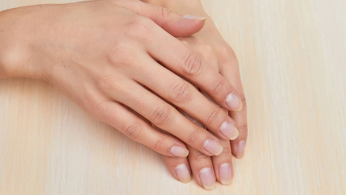 நகத்தில் வெள்ளை புள்ளிகள் விழுவது அதிர்ஷ்டமா? நோய் அறிகுறியா? நகங்கள் பற்றி தெரியுமா?