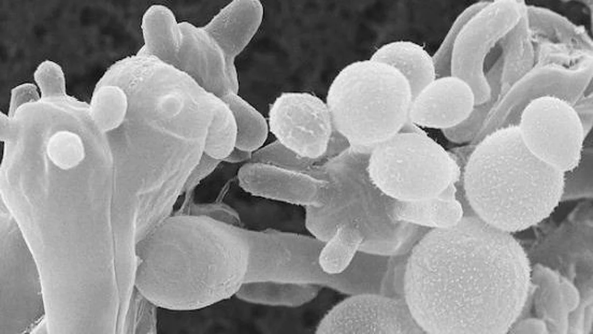 White Fungus: দেশে ব্ল্যাকের থেকেও মারাত্মক ফাঙ্গাসের উপস্থিতিতে আতঙ্ক চিকিৎসকমহলে