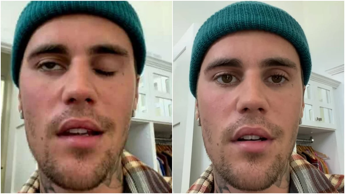 Justin Bieber: মুখে পক্ষাঘাতে আক্রান্ত পপ-গায়ক, বাতিল করলেন ওয়ার্ল্ড ট্যুর কনসার্ট