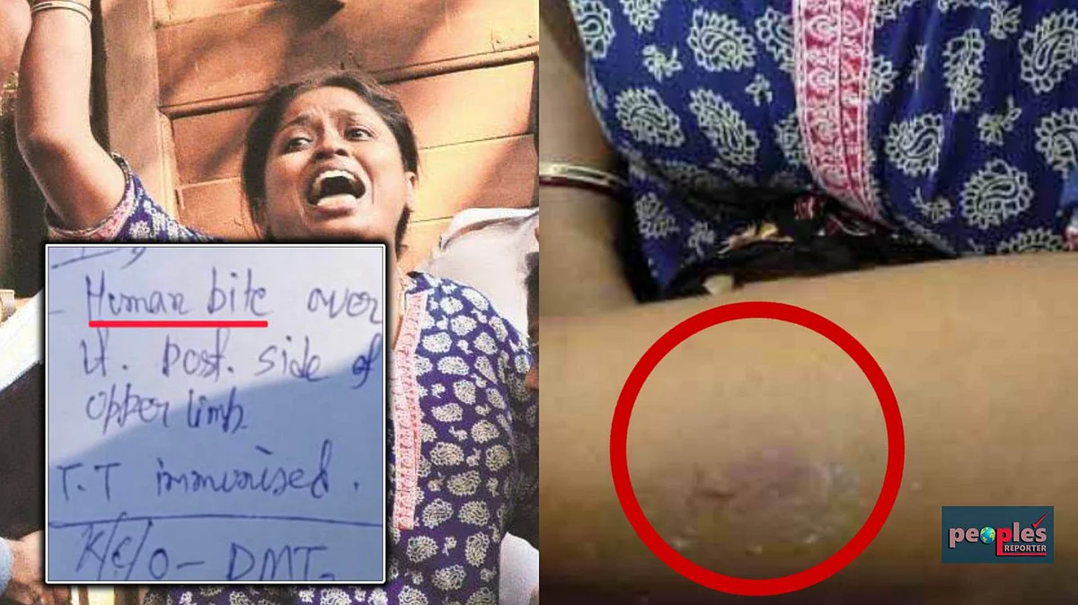 আক্রান্ত চাকরিপ্রার্থী অরুণিমা পাল