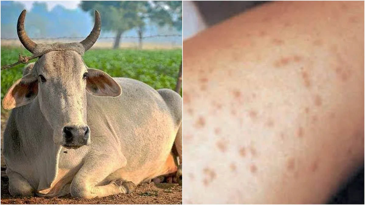 ব্রুসেলোসিস রোগ