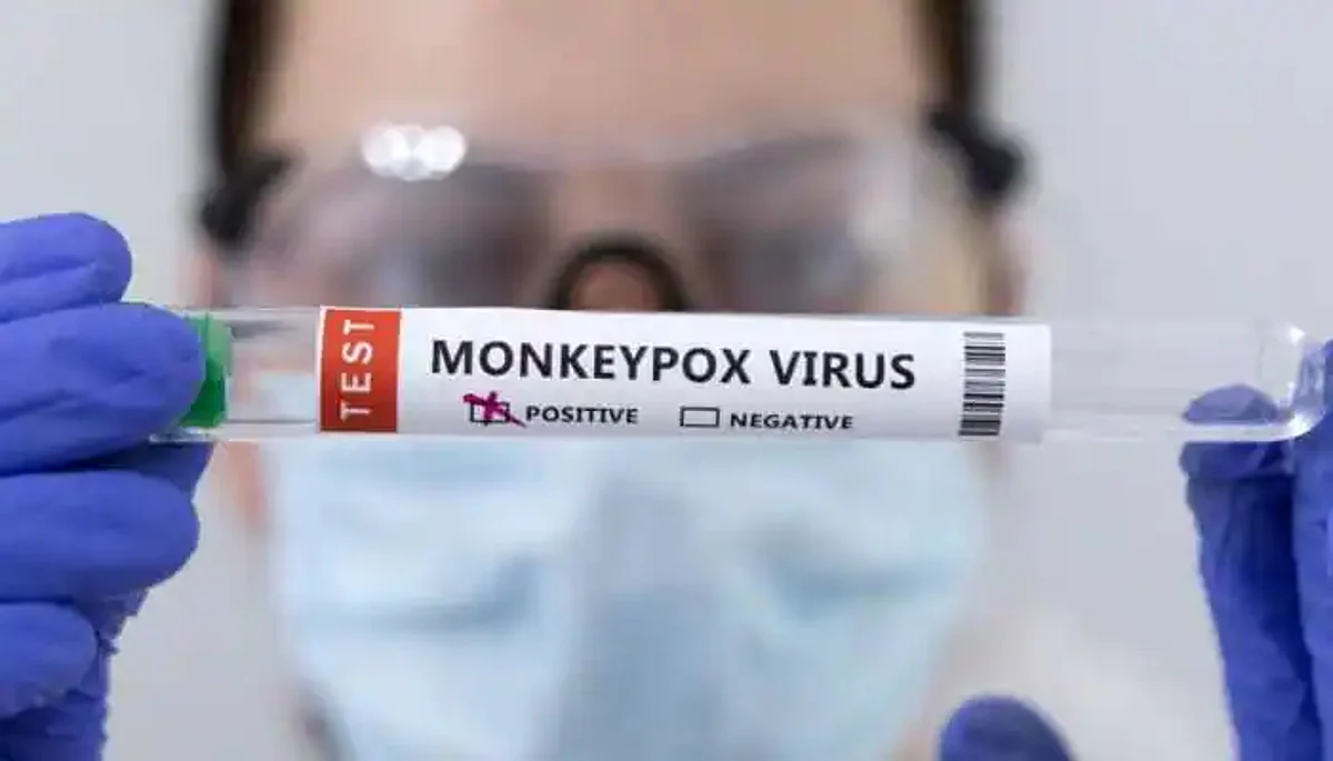 India Registers 2nd Case of Monkeypox in Kerala