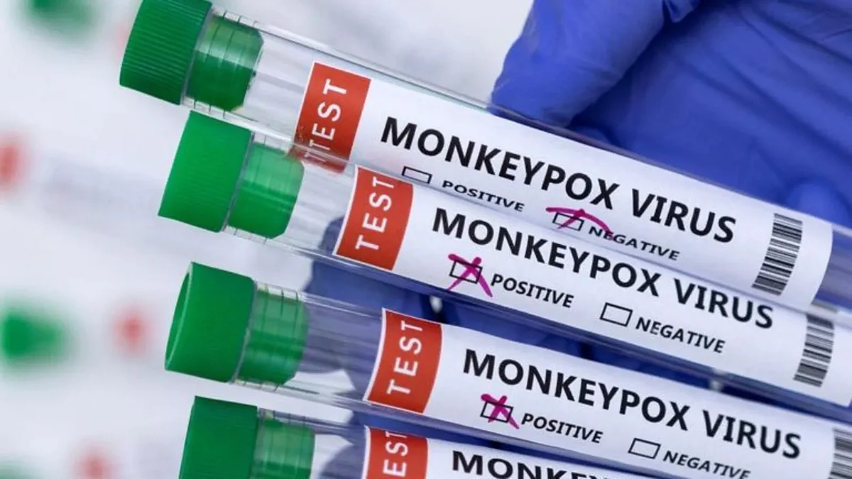Monkeypox virus