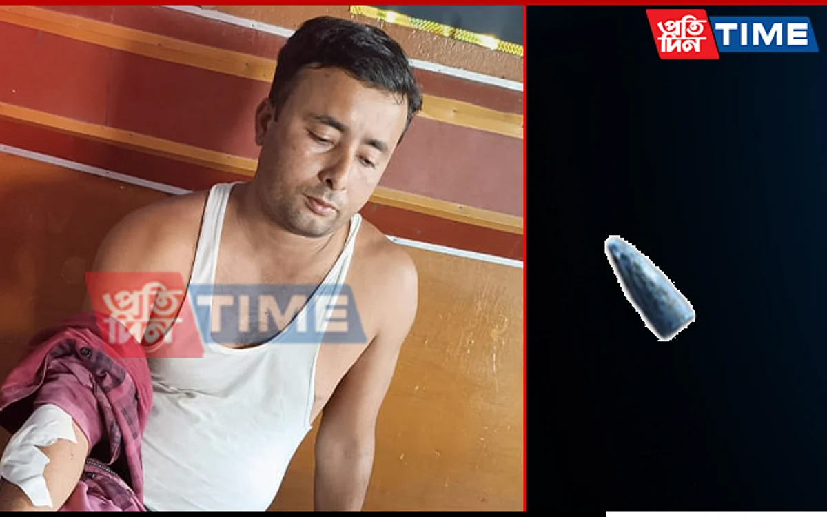 Man Allegedly Hit By Stray Bullet From Firing Range at Rani