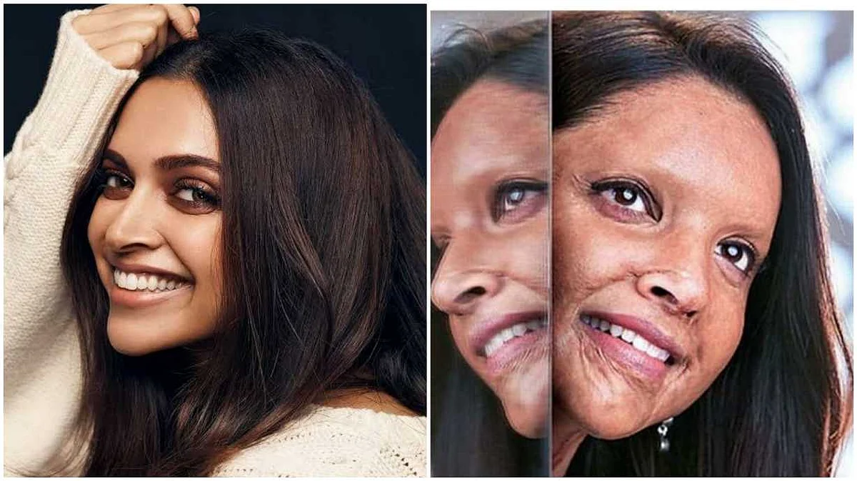 Deepika’s ‘Chhapaak’ look creates sensation