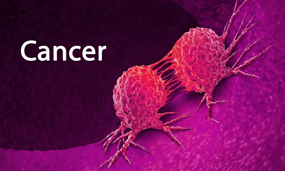 Assam: 66,800 People Die of Cancer in the Last 3 Years
