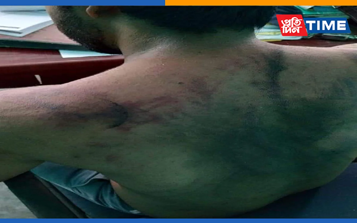 Assam: Protests Erupt Across State over Doctor Assault Case