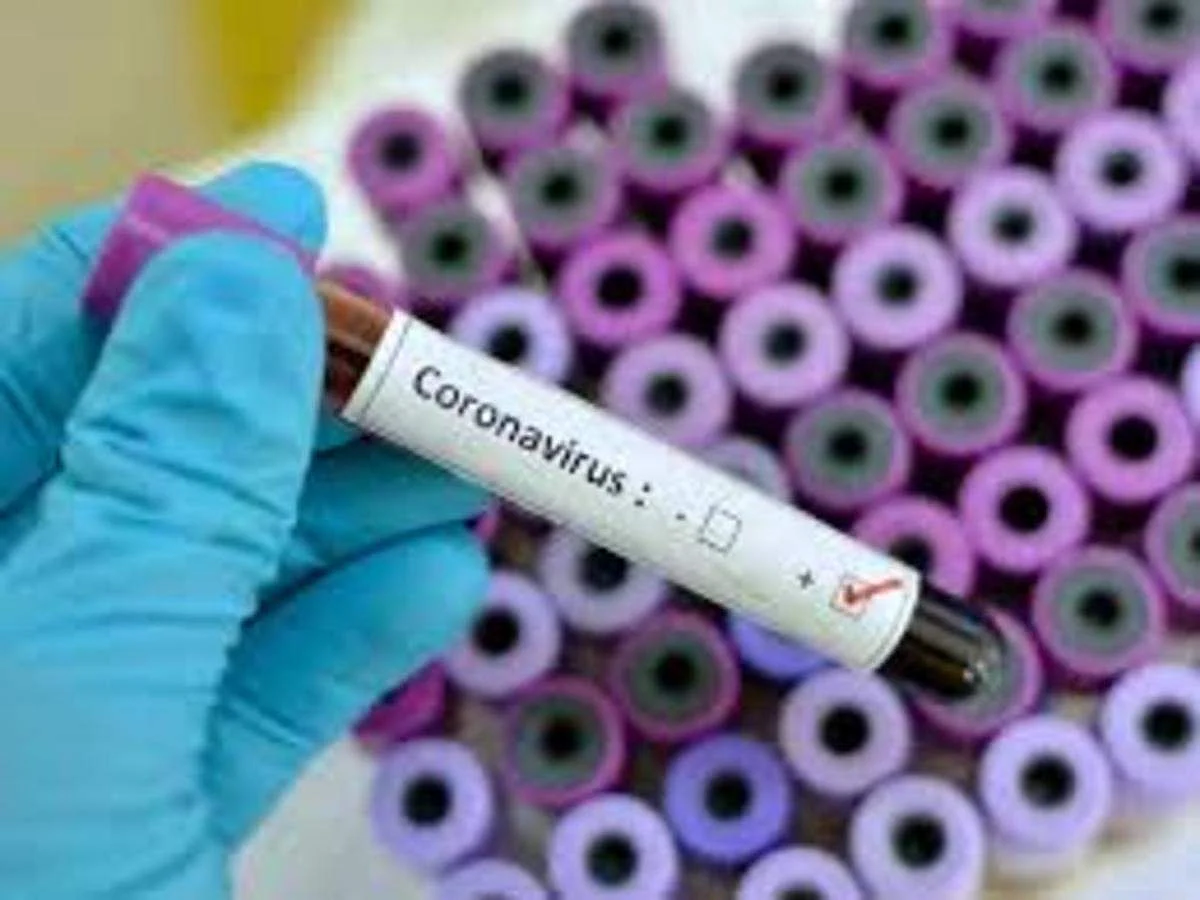 South Africa Returnee Tests Positive for COVID-19 In Chandigarh